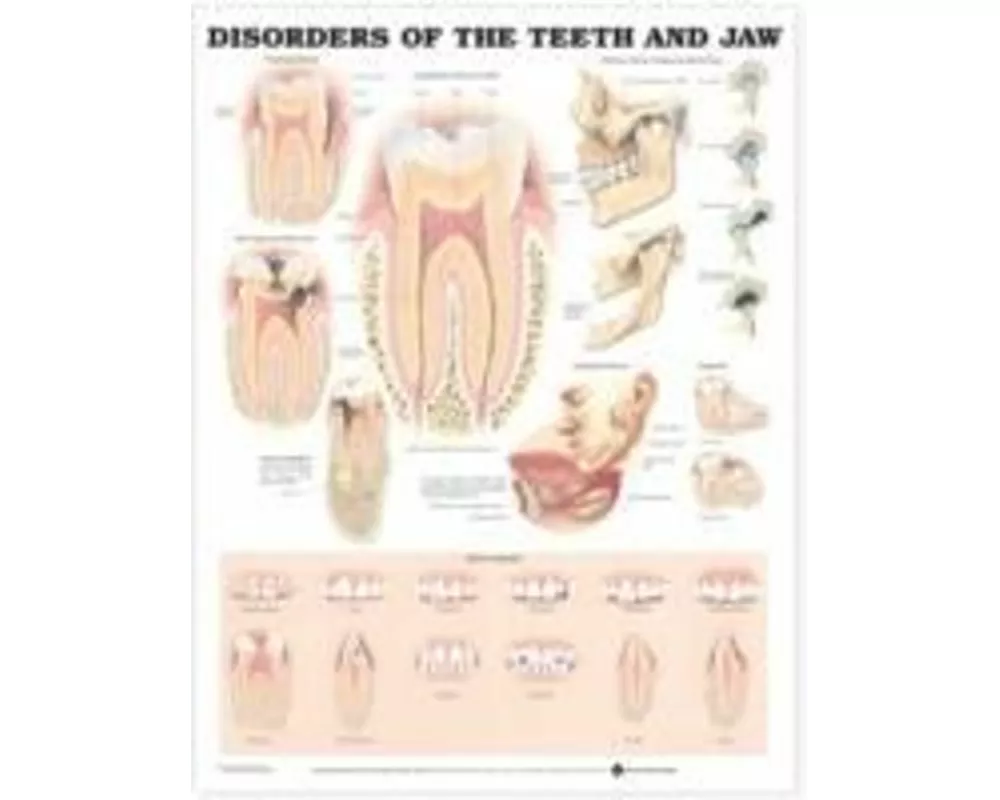 Disorders of the Teeth and Jaw Anatomical Chart
