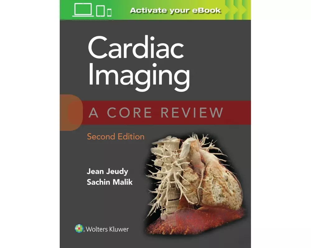 Cardiac Imaging: A Core Review