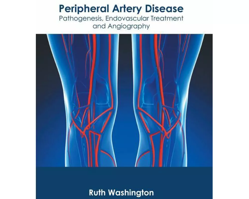 Peripheral Artery Disease: Pathogenesis, Endovascular Treatment and Angiography