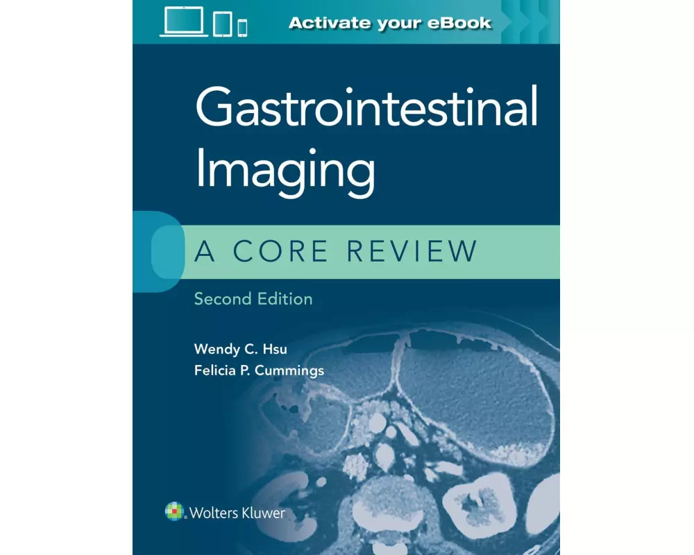 Gastrointestinal Imaging: A Core Review