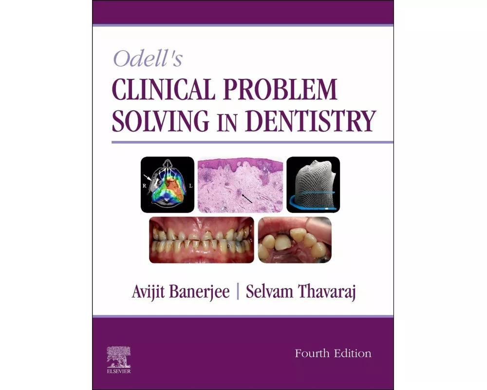 Odell's Clinical Problem Solving in Dentistry