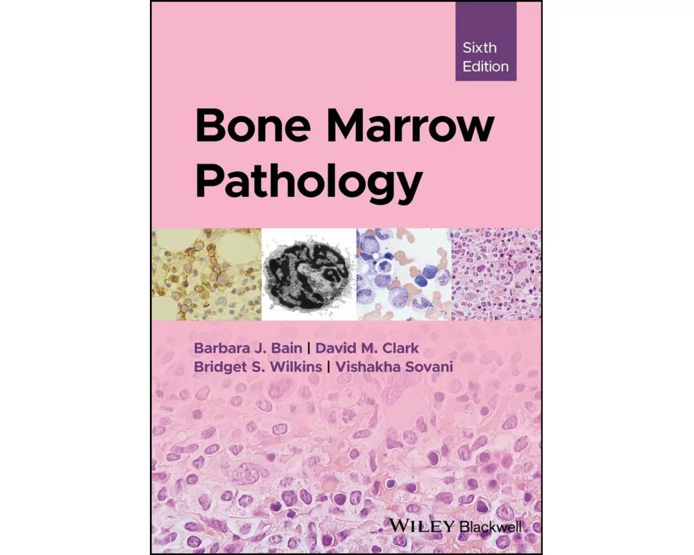 Bone Marrow Pathology