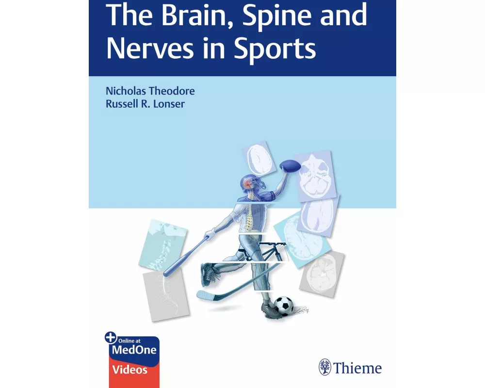 The Brain, Spine and Nerves in Sports