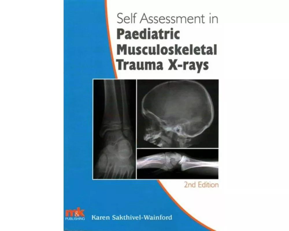 Self-Assessment in Paediatric Musculoskeletal Trauma X-Rays