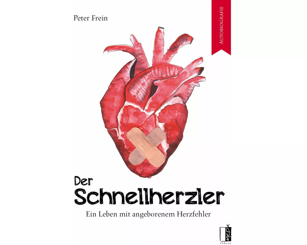 Der Schnellherzler