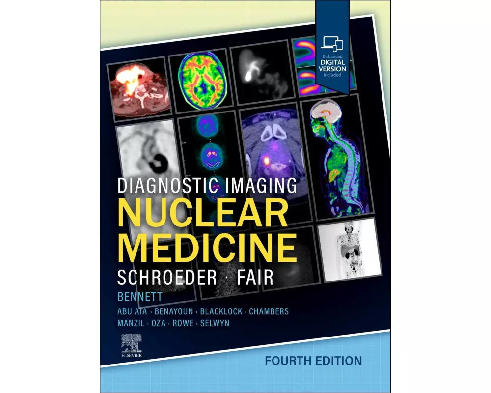 Diagnostic Imaging: Nuclear Medicine