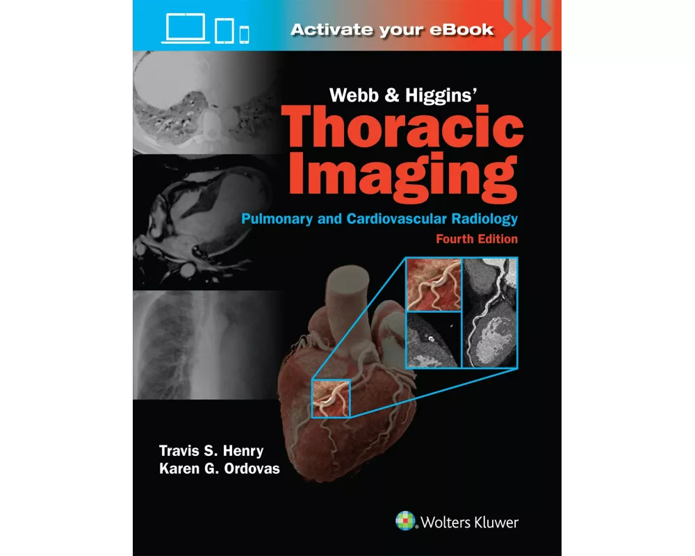 Webb & Higgins Thoracic Imaging: Print + eBook with Multimedia