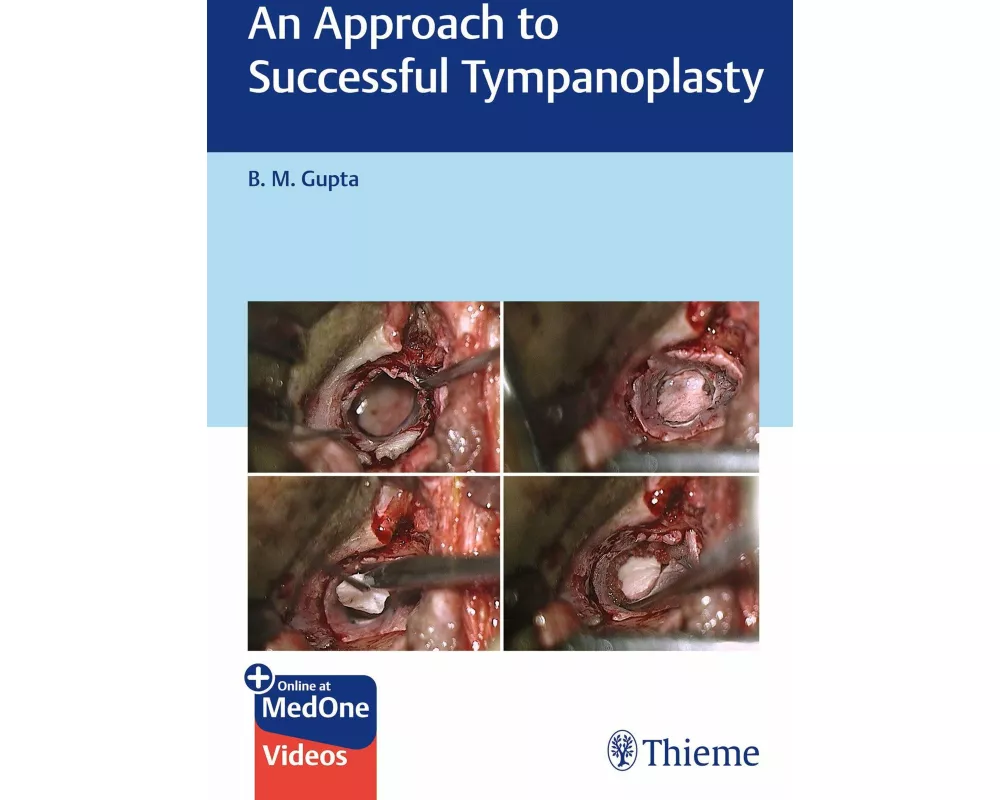 An Approach to Successful Tympanoplasty