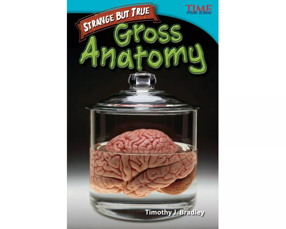 Strange But True: Gross Anatomy