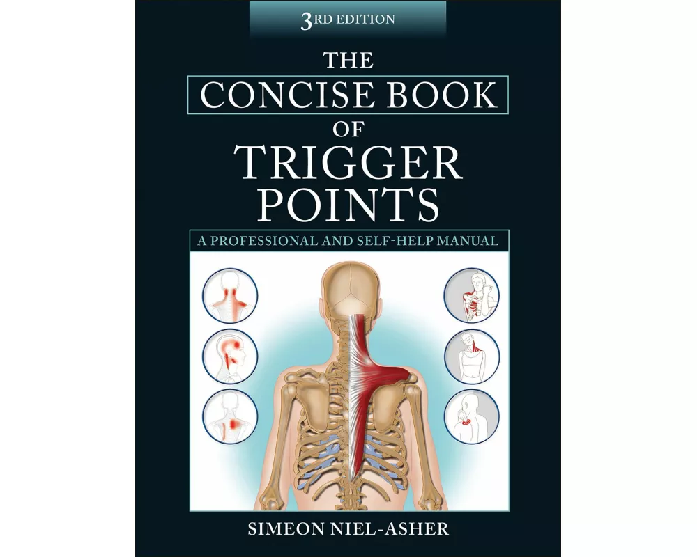 The Concise Book of Trigger Points