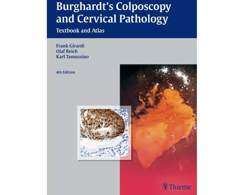 Burghardt's Colposcopy and Cervical Pathology
