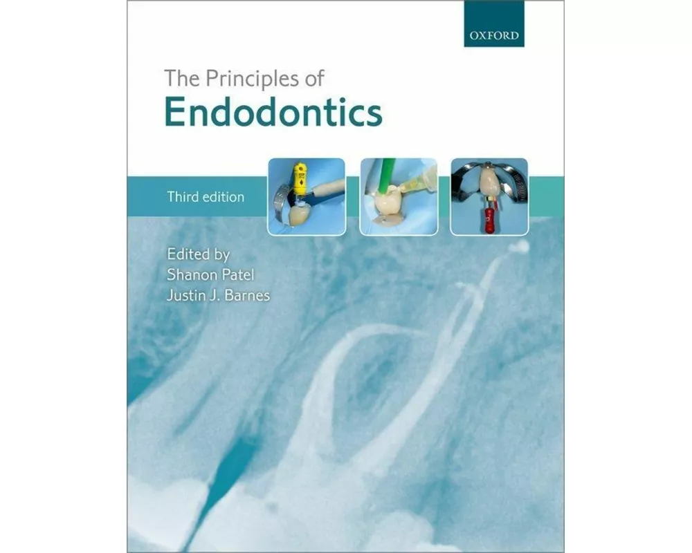 Principles of Endodontics