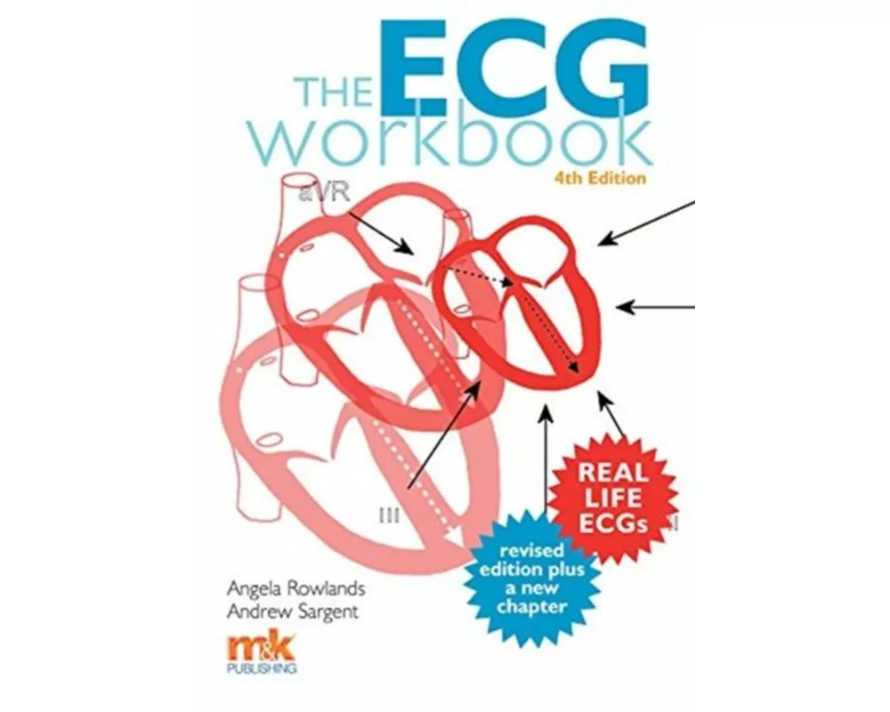 The ECG Workbook