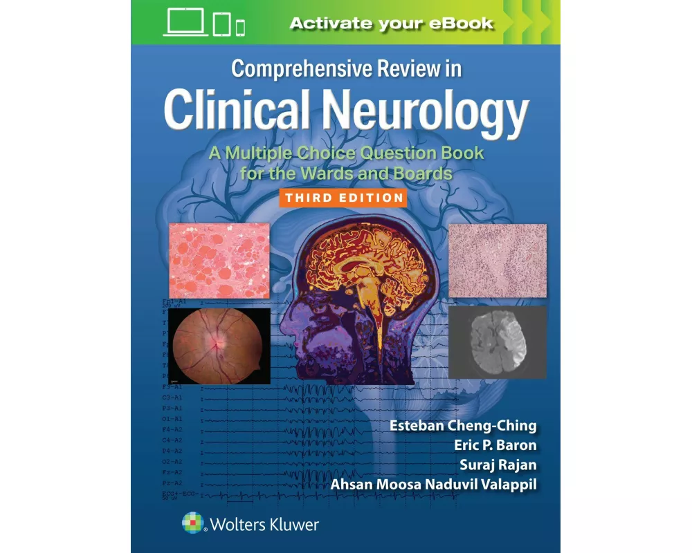 Comprehensive Review in Clinical Neurology