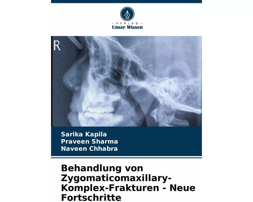 Behandlung von Zygomaticomaxillary-Komplex-Frakturen - Neue Fortschritte