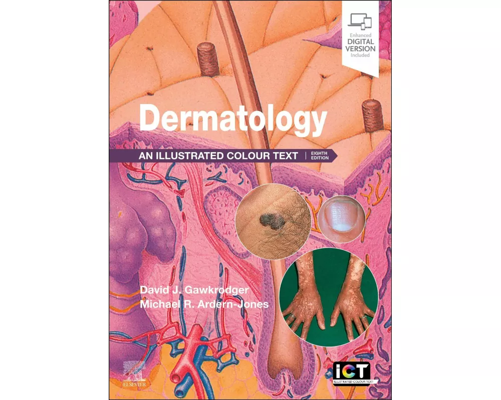 Dermatology