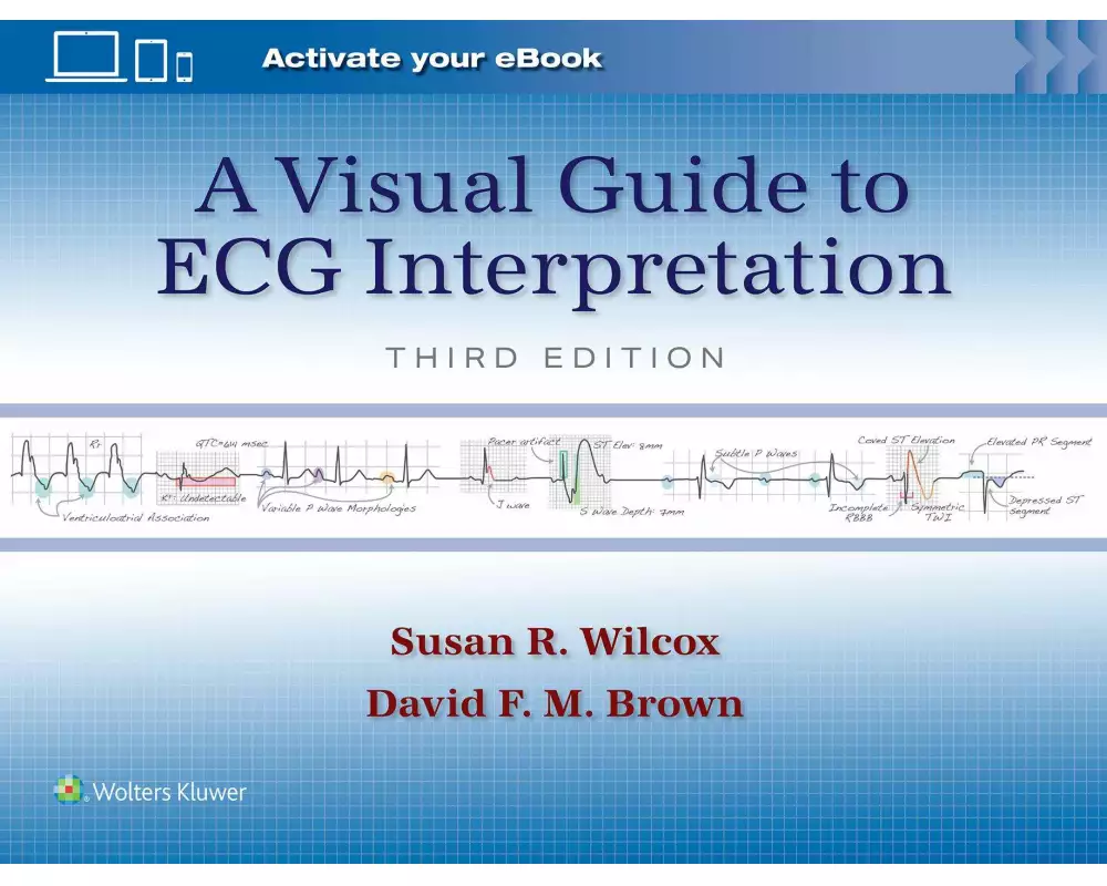 A Visual Guide to ECG Interpretation: Print + eBook with Multimedia
