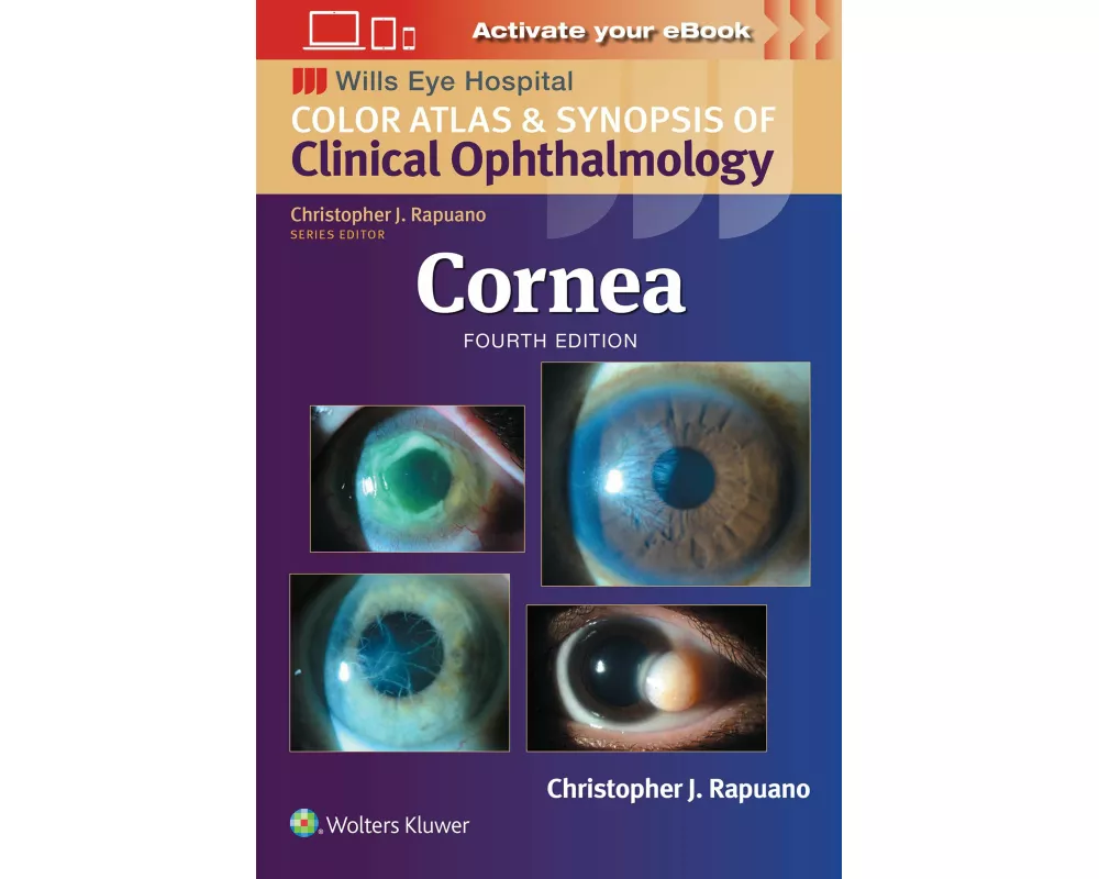Cornea: Print + eBook with Multimedia