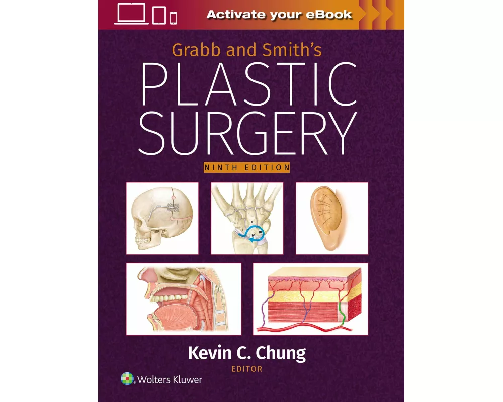 Grabb and Smith's Plastic Surgery: Print + eBook with Multimedia