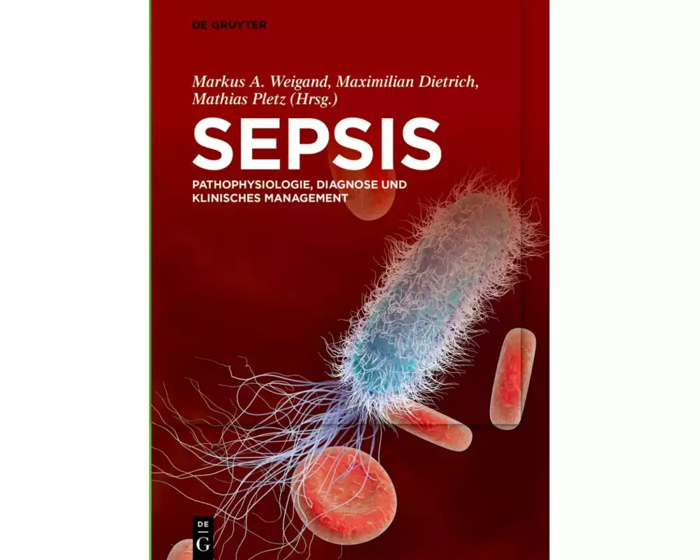 Sepsis