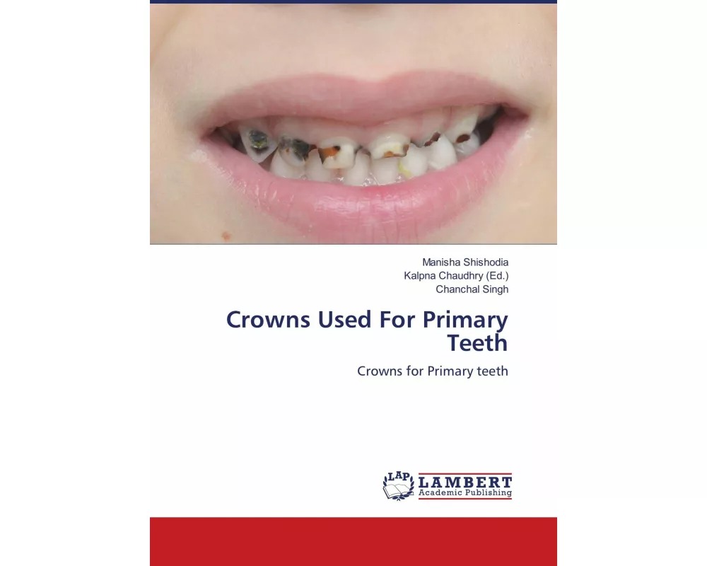 Crowns Used For Primary Teeth