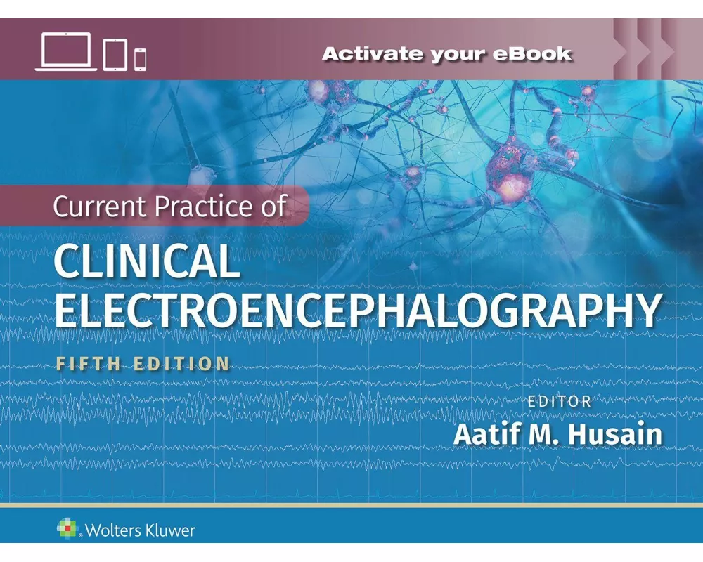 Current Practice of Clinical Electroencephalography