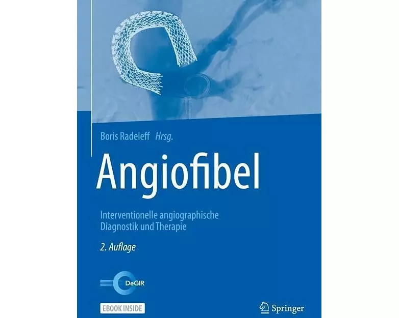 Angiofibel