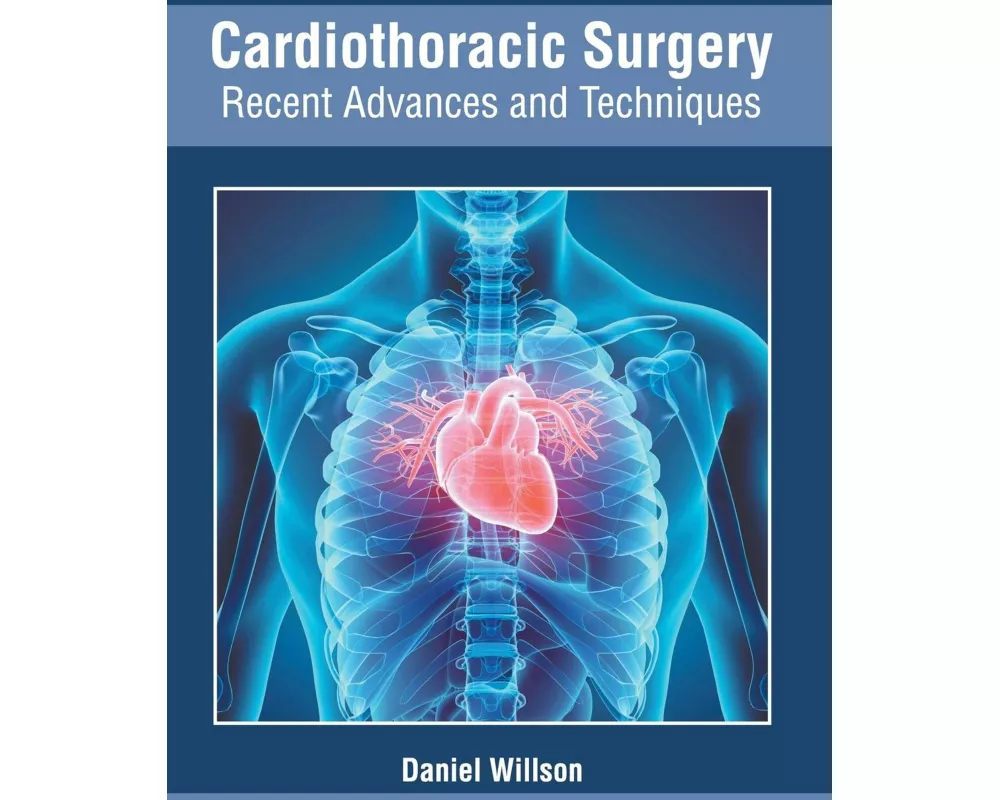 Cardiothoracic Surgery