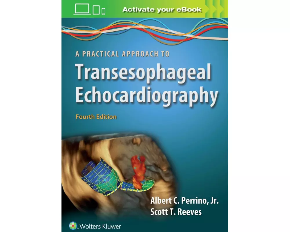 A Practical Approach to Transesophageal Echocardiography