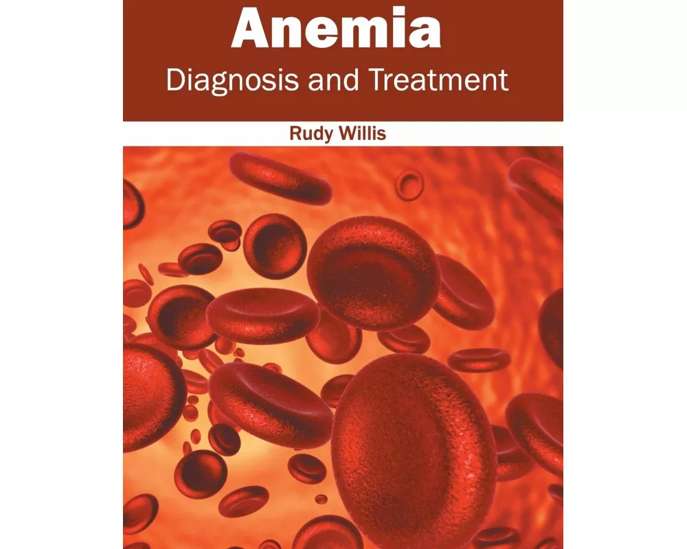 Anemia: Diagnosis and Treatment