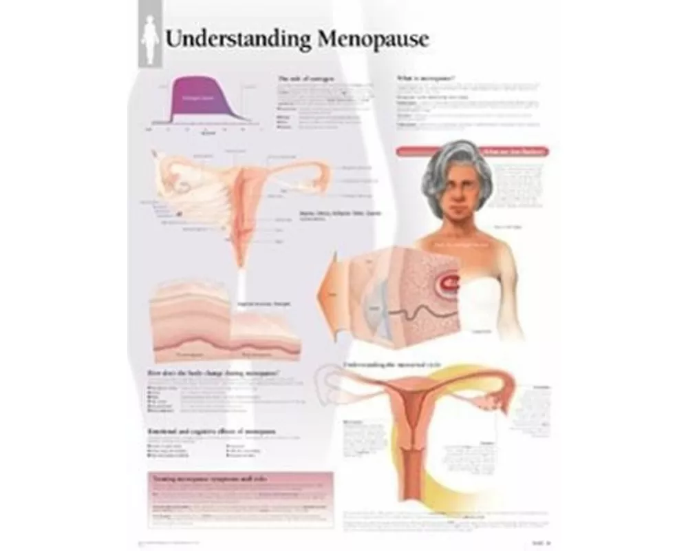 Understanding Menopause Laminated Poster