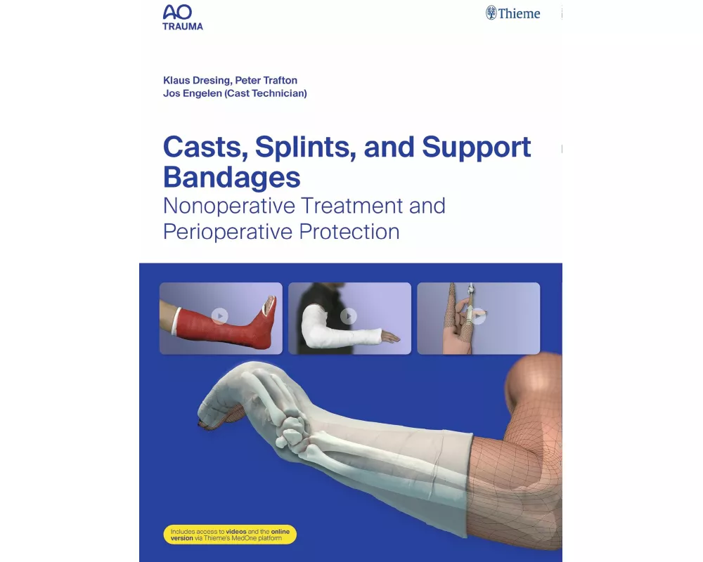 Casts, Splints, and Support Bandages