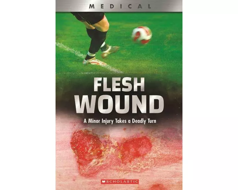 Flesh Wound: A Minor Injury Takes a Deadly Turn (XBooks)