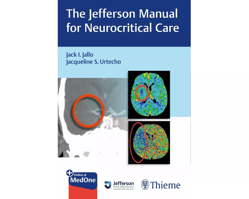 The Jefferson Manual for Neurocritical Care