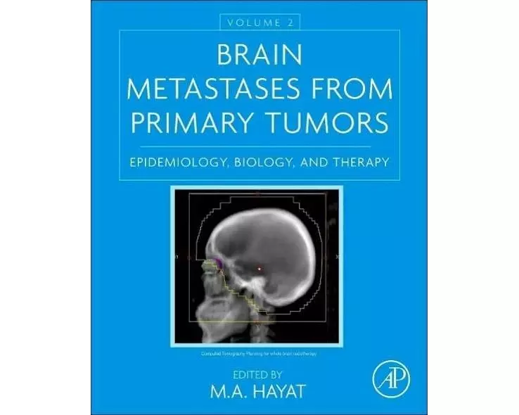 Brain Metastases from Primary Tumors, Volume 2