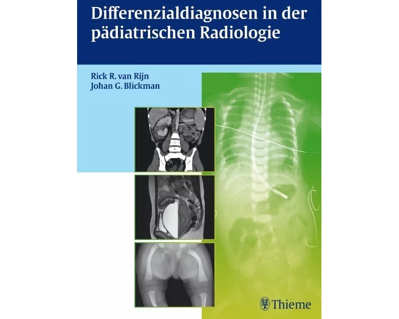 Differenzialdiagnosen in der pädiatrischen Radiologie
