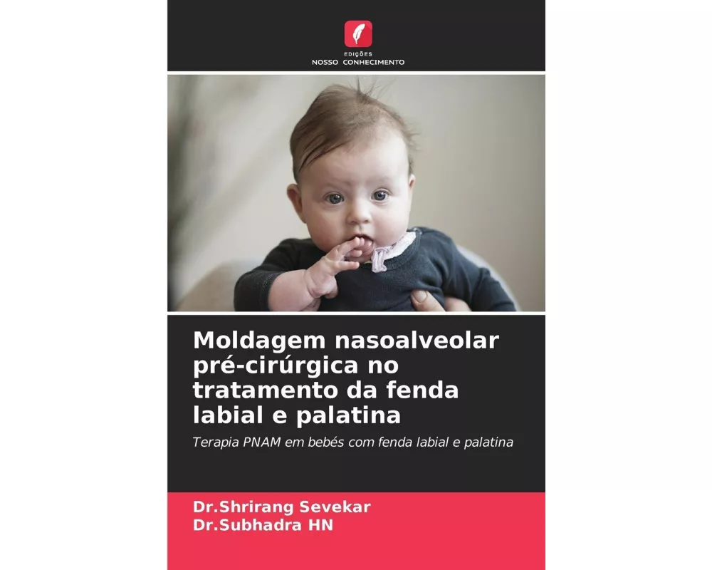 Moldagem nasoalveolar pré-cirúrgica no tratamento da fenda labial e palatina
