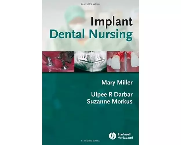 Implant Dental Nursing