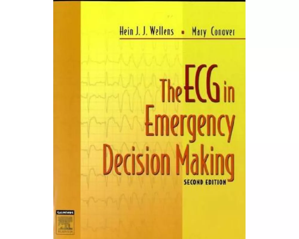 The ECG in Emergency Decision Making