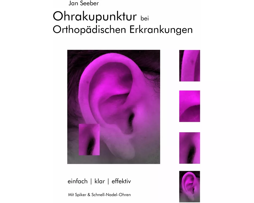 Ohrakupunktur bei Orthopädischen Erkrankungen