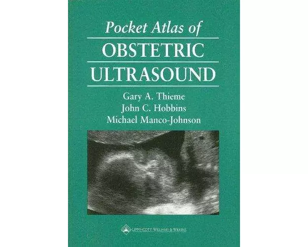 Pocket Atlas of Obstetric Ultrasound