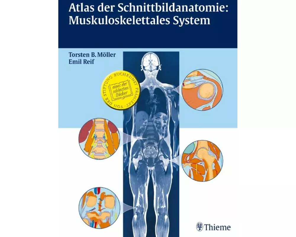 Atlas der Schnittbildanatomie: Muskuloskelettales System
