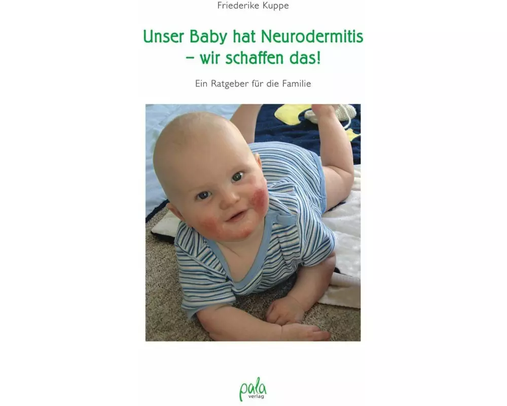 Unser Baby hat Neurodermitis - wir schaffen das!