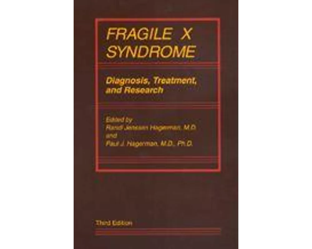 Fragile X Syndrome