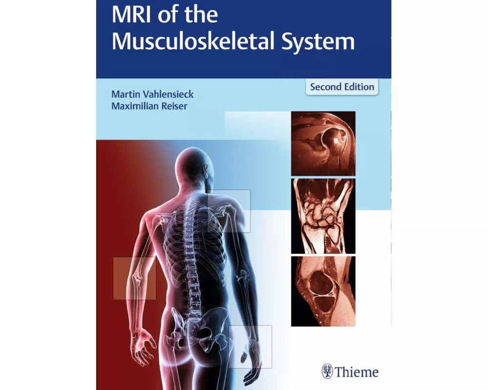 MRI of the Musculoskeletal System