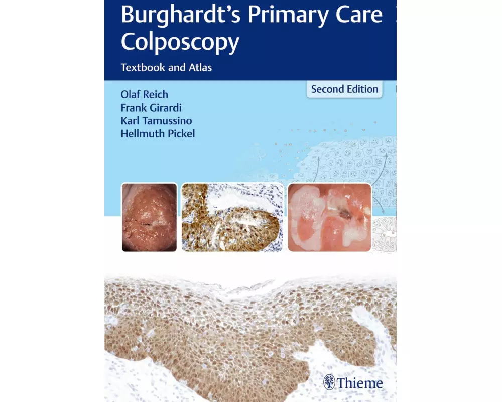 Burghardt's Primary Care Colposcopy