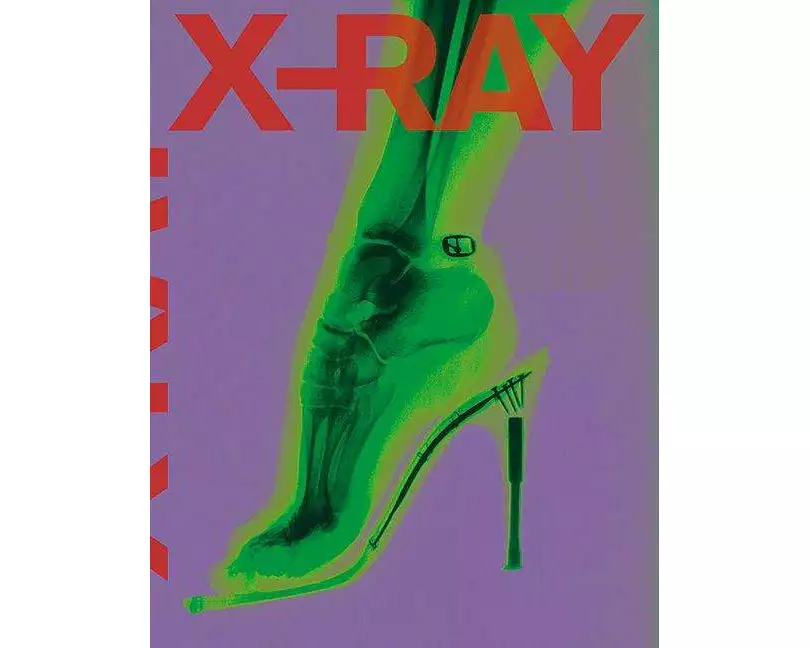 X-ray