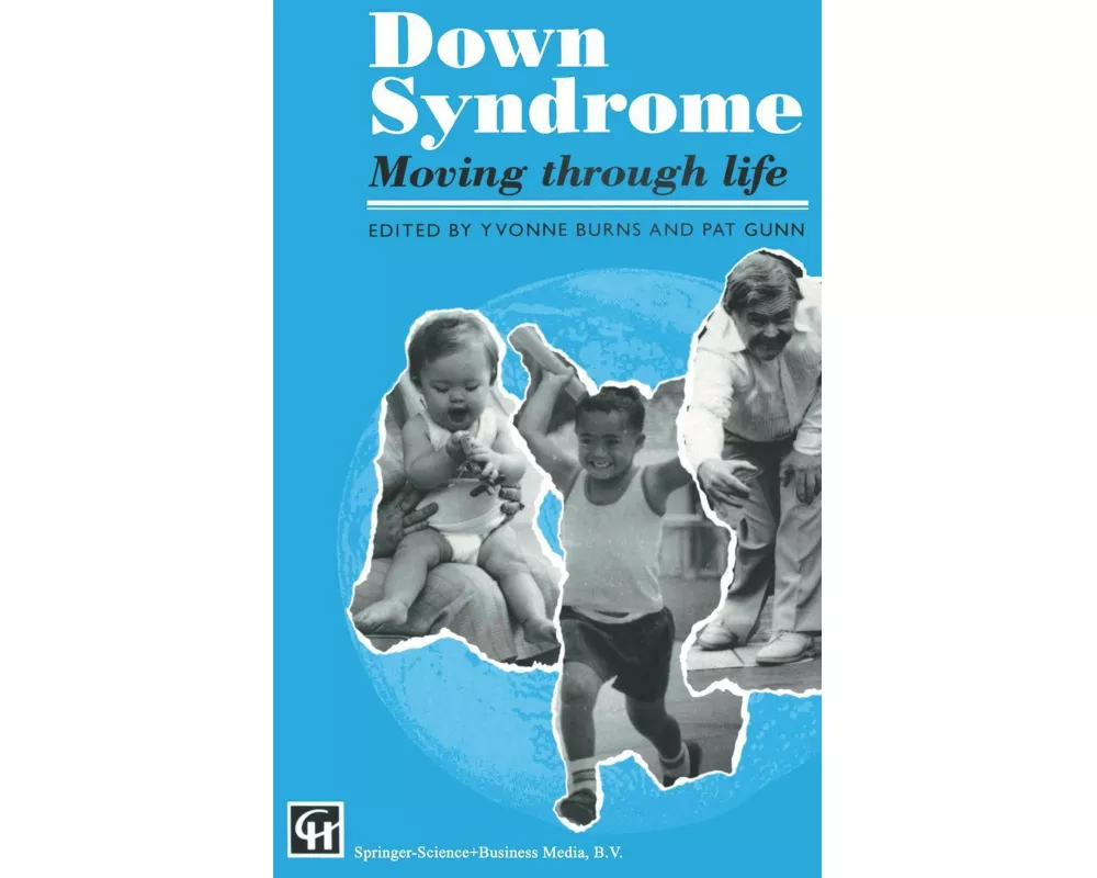 Down Syndrome