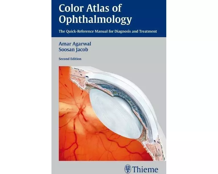 Color Atlas of Ophthalmology