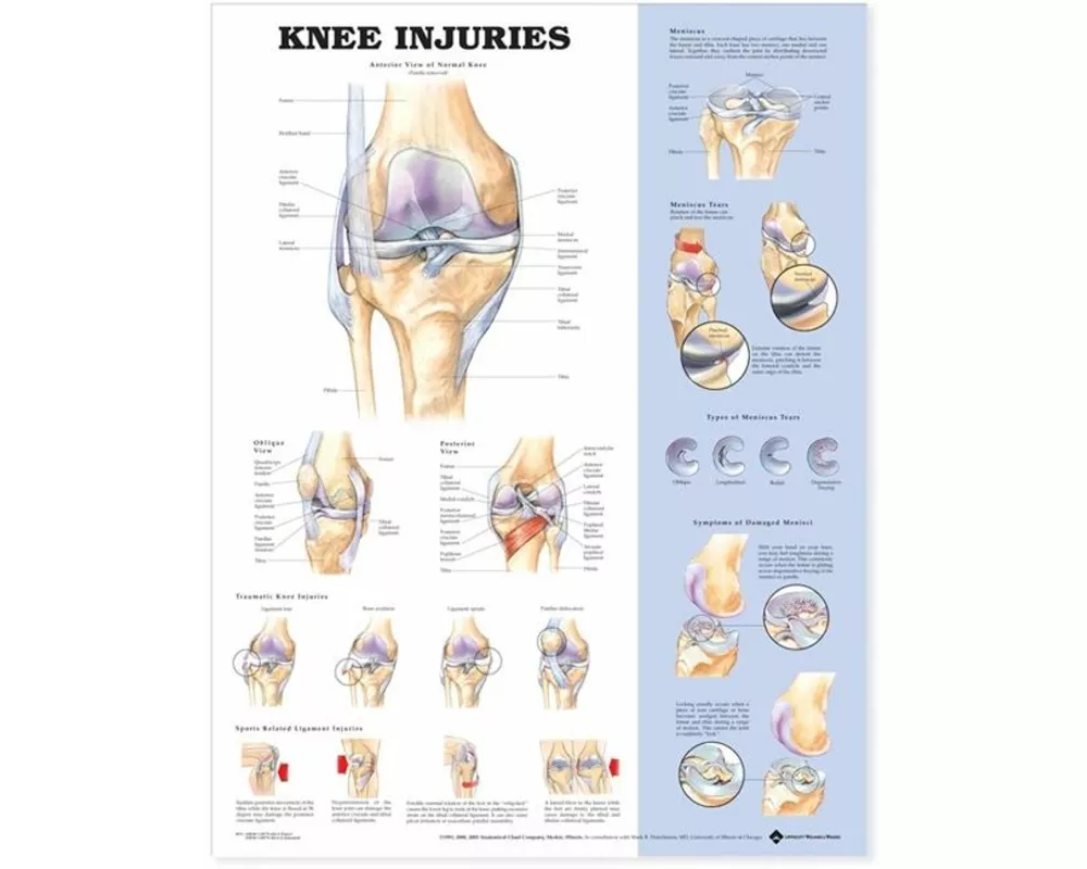 Knee Injuries Anatomical Chart